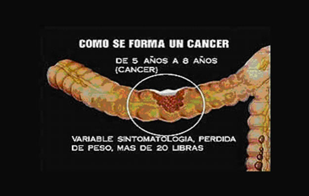 colon cancer k